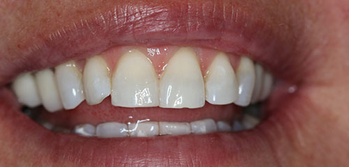 Sedation Dentist in Phoenix