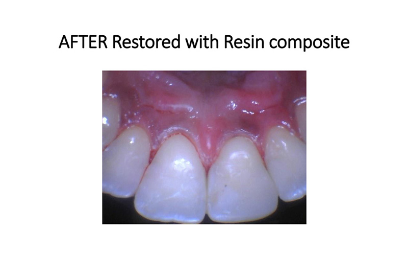 Emergency Dentist Phoenix