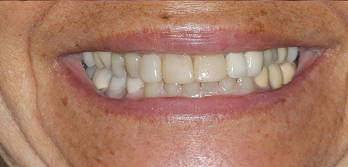 Phoenix Cosmetic Dentist