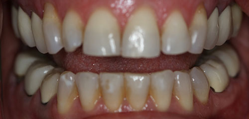 Phoenix Cosmetic Dentist