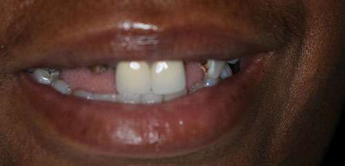 Sedation Dentist in Phoenix