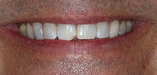 Emergency Dentist Phoenix