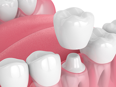 Ahwatukee Dentistry